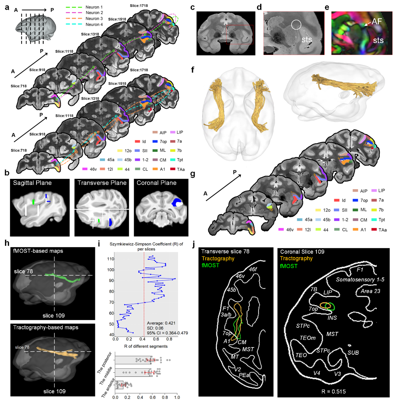 整合fMOST与dMRI的猕猴弓状束通路建模